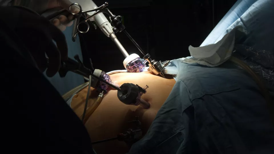 Photograph of gastric bypass surgery in hospital.