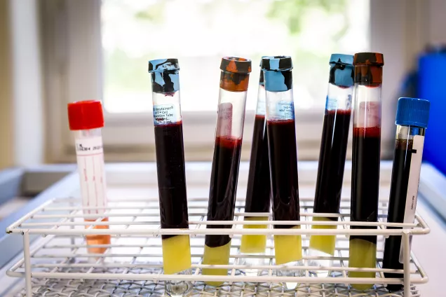 Photo of blood samples.