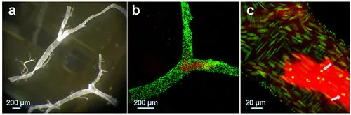 atherosclerotic plaque formation